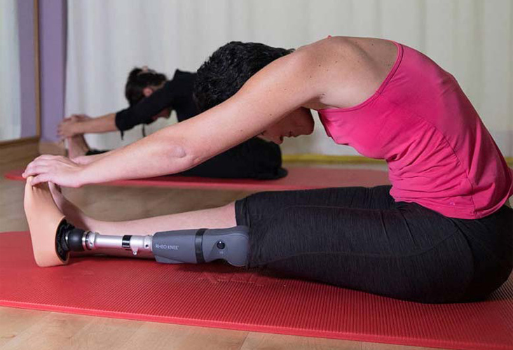 woman with Prosthetic leg stretching