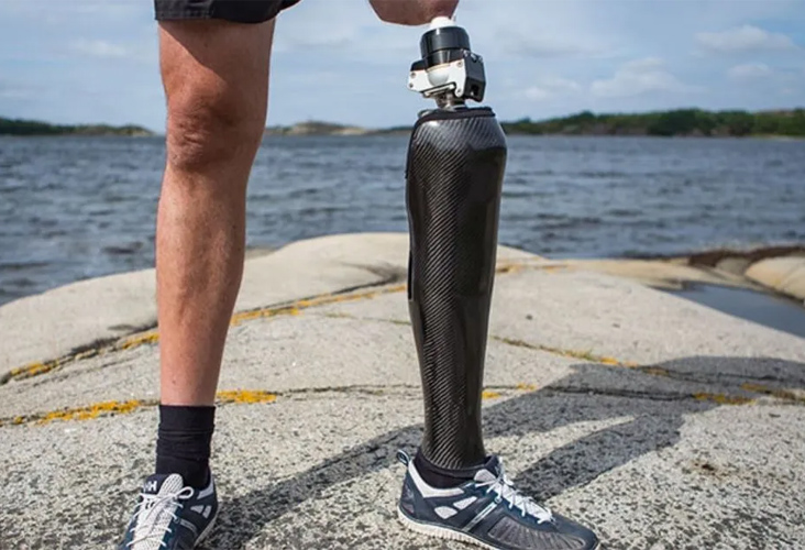 close up of a prosthetic leg on a man standing near a lake