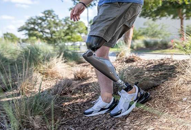 Man on hill with prosthetic leg showcases top-tier prosthetic devices in New York and New Jersey